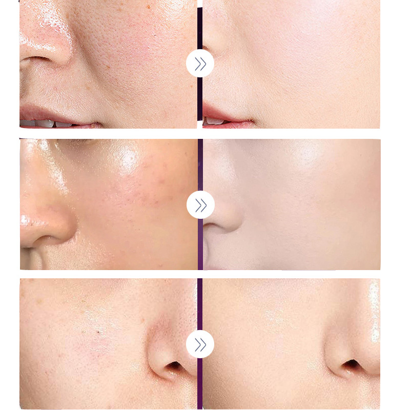 Luxo nobre senhora pérola bran - Skincare Luxury Whitening avaliação e preço